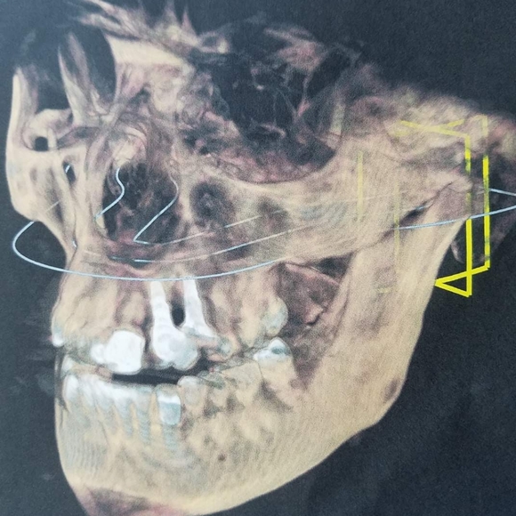 ⚠️Med.Photos ⚠️Warning - Picture 3 of 9